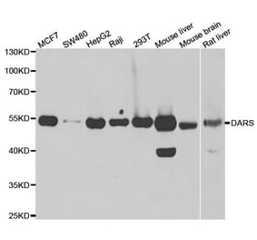 Western blot - DARS antibody from Signalway Antibody (39018) - Antibodies.com