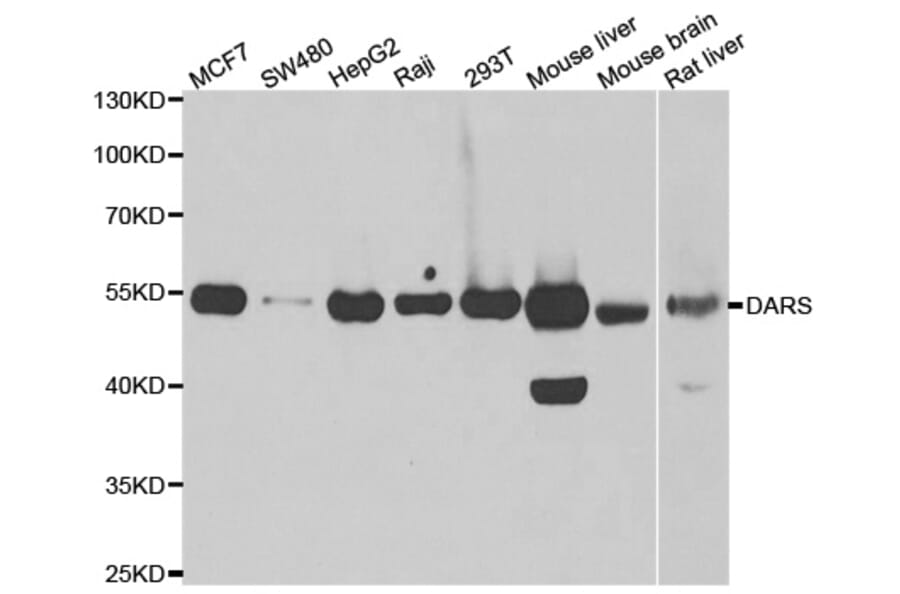 Western blot - DARS antibody from Signalway Antibody (39018) - Antibodies.com