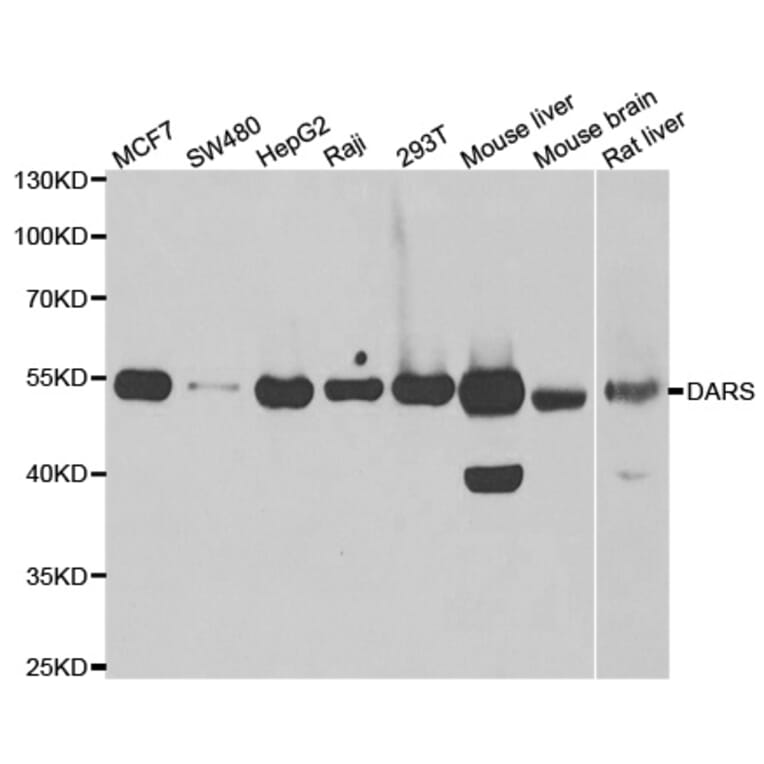 Western blot - DARS antibody from Signalway Antibody (39018) - Antibodies.com