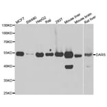Western blot - DARS antibody from Signalway Antibody (39018) - Antibodies.com