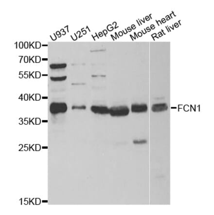 Western blot - FCN1 antibody from Signalway Antibody (39027) - Antibodies.com