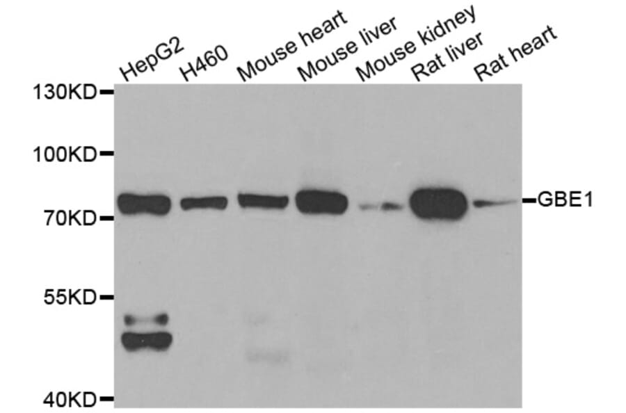 Western blot - GBE1 antibody from Signalway Antibody (39035) - Antibodies.com