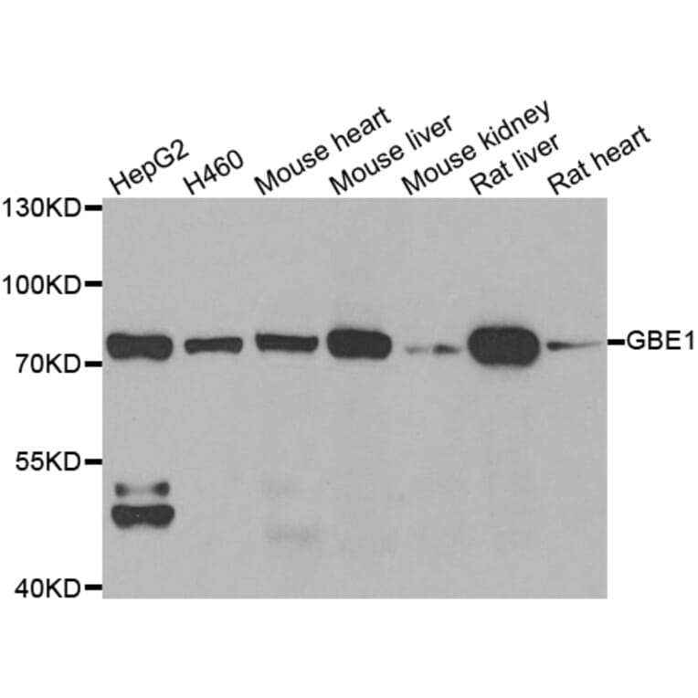 Western blot - GBE1 antibody from Signalway Antibody (39035) - Antibodies.com