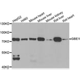 Western blot - GBE1 antibody from Signalway Antibody (39035) - Antibodies.com