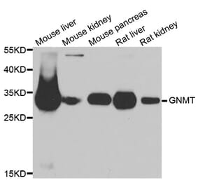 Western blot - GNMT antibody from Signalway Antibody (39040) - Antibodies.com