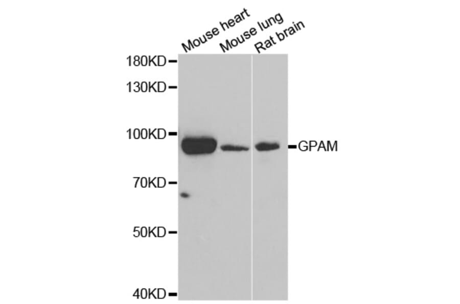Western blot - GPAM antibody from Signalway Antibody (39042) - Antibodies.com