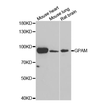 Western blot - GPAM antibody from Signalway Antibody (39042) - Antibodies.com