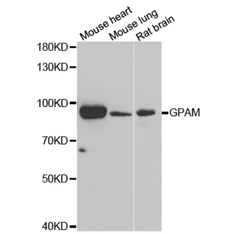 Western blot - GPAM antibody from Signalway Antibody (39042) - Antibodies.com