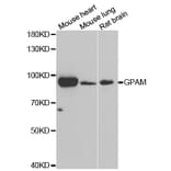 Western blot - GPAM antibody from Signalway Antibody (39042) - Antibodies.com