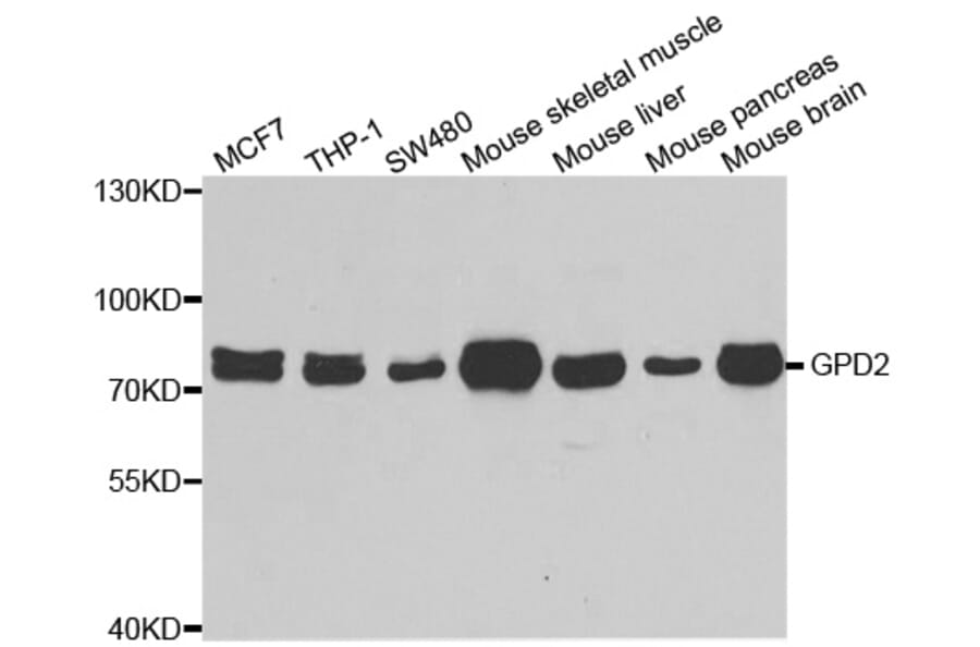 Western blot - GPD2 antibody from Signalway Antibody (39043) - Antibodies.com