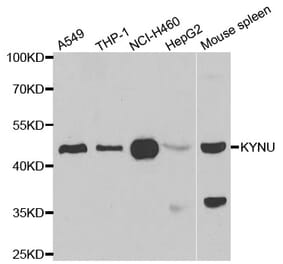 Western blot - KYNU antibody from Signalway Antibody (39066) - Antibodies.com