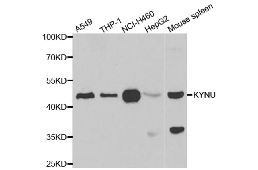 Western blot - KYNU antibody from Signalway Antibody (39066) - Antibodies.com