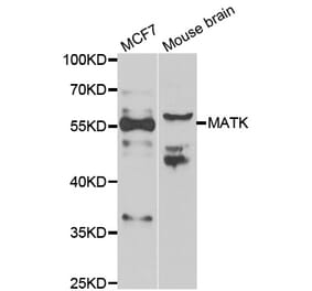 Western blot - MATK antibody from Signalway Antibody (39072) - Antibodies.com