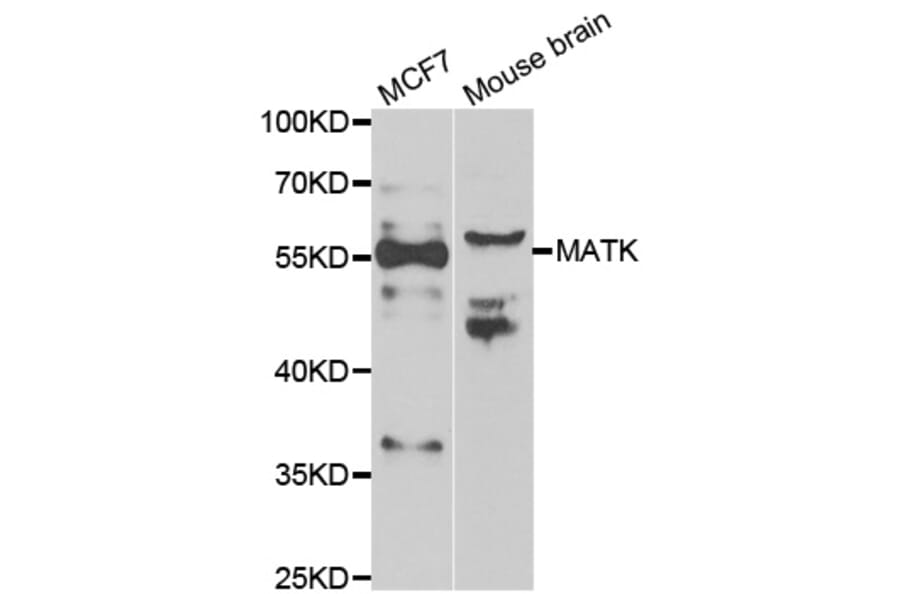 Western blot - MATK antibody from Signalway Antibody (39072) - Antibodies.com