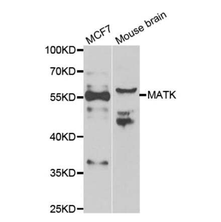 Western blot - MATK antibody from Signalway Antibody (39072) - Antibodies.com