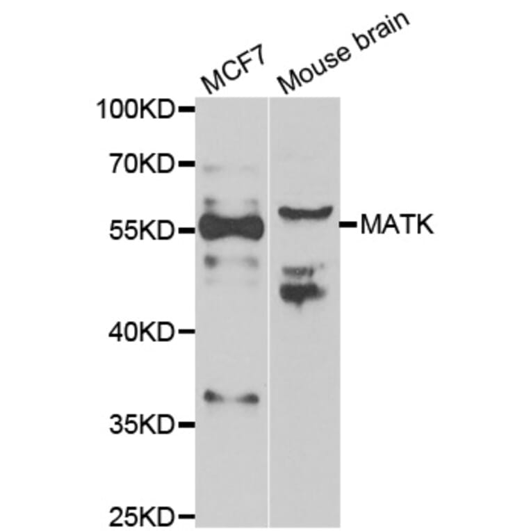 Western blot - MATK antibody from Signalway Antibody (39072) - Antibodies.com