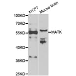 Western blot - MATK antibody from Signalway Antibody (39072) - Antibodies.com