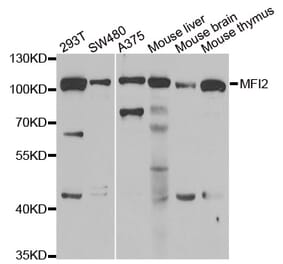 Western blot - MFI2 antibody from Signalway Antibody (39073) - Antibodies.com