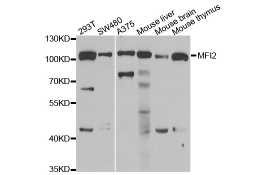 Western blot - MFI2 antibody from Signalway Antibody (39073) - Antibodies.com
