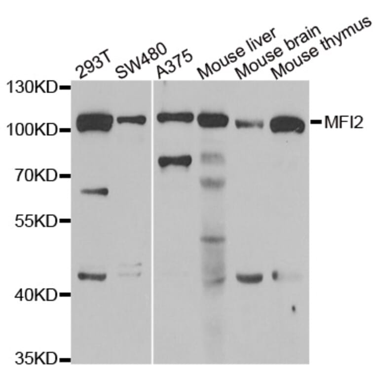 Western blot - MFI2 antibody from Signalway Antibody (39073) - Antibodies.com