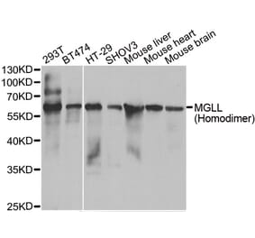Western blot - MGLL antibody from Signalway Antibody (39074) - Antibodies.com