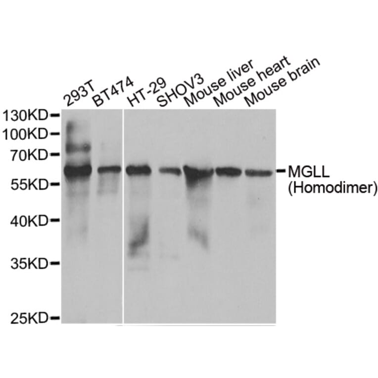 Western blot - MGLL antibody from Signalway Antibody (39074) - Antibodies.com