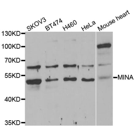 Western blot - MINA antibody from Signalway Antibody (39075) - Antibodies.com