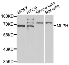 Western blot - MLPH antibody from Signalway Antibody (39076) - Antibodies.com
