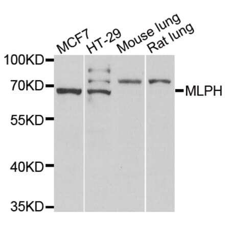 Western blot - MLPH antibody from Signalway Antibody (39076) - Antibodies.com
