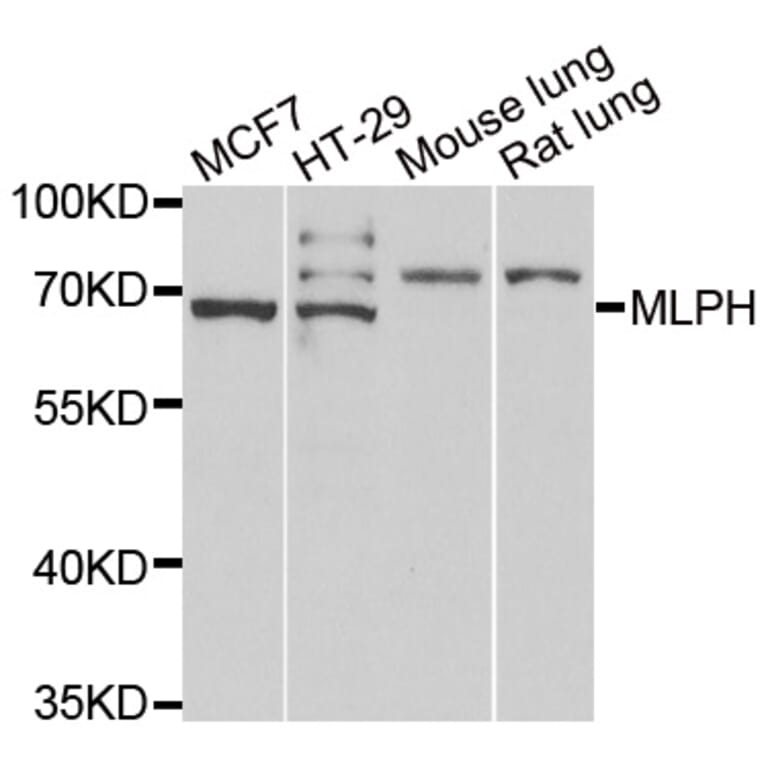 Western blot - MLPH antibody from Signalway Antibody (39076) - Antibodies.com