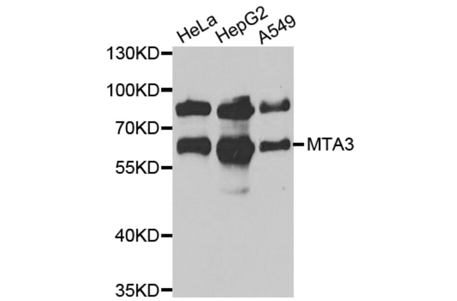 Western blot - MTA3 antibody from Signalway Antibody (39080) - Antibodies.com