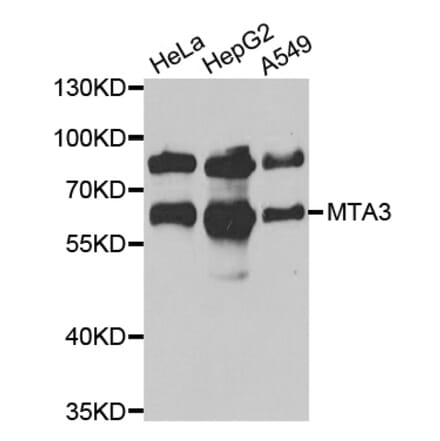 Western blot - MTA3 antibody from Signalway Antibody (39080) - Antibodies.com