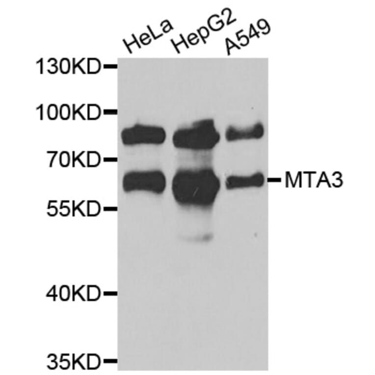 Western blot - MTA3 antibody from Signalway Antibody (39080) - Antibodies.com