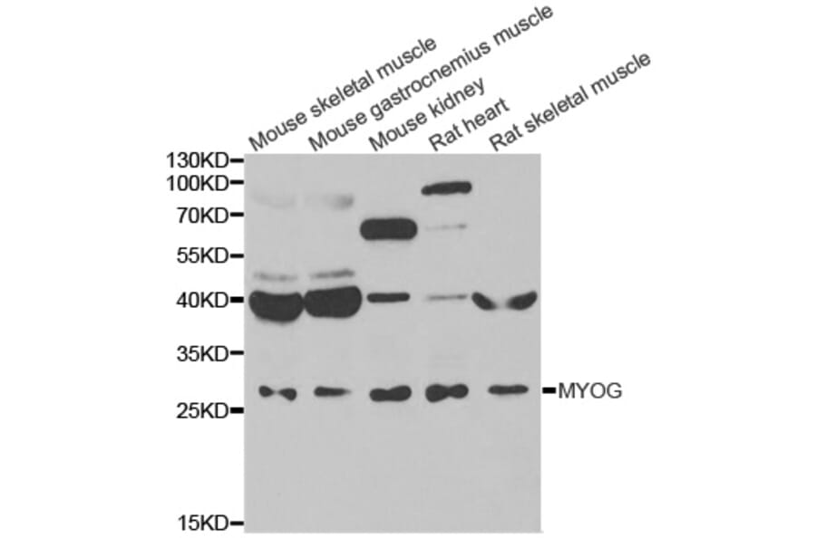 Western blot - MYOG antibody from Signalway Antibody (39084) - Antibodies.com