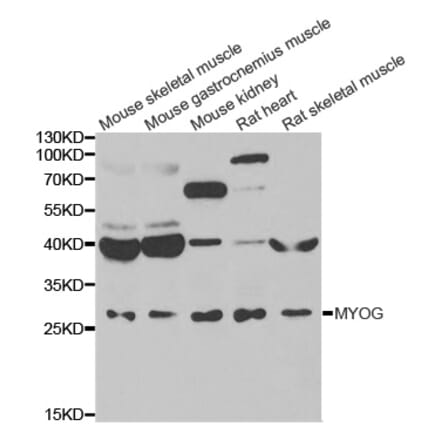 Western blot - MYOG antibody from Signalway Antibody (39084) - Antibodies.com