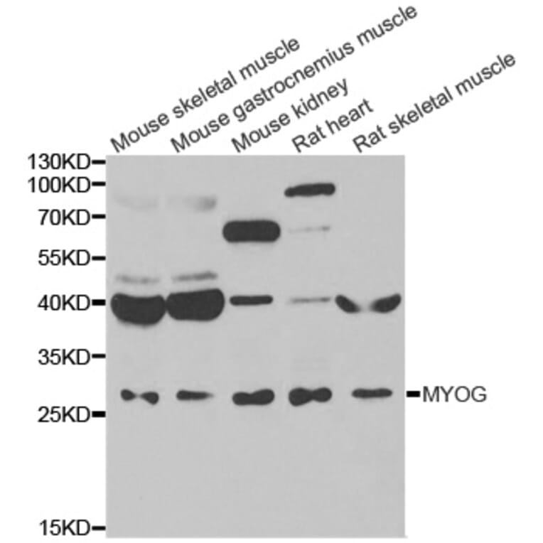 Western blot - MYOG antibody from Signalway Antibody (39084) - Antibodies.com