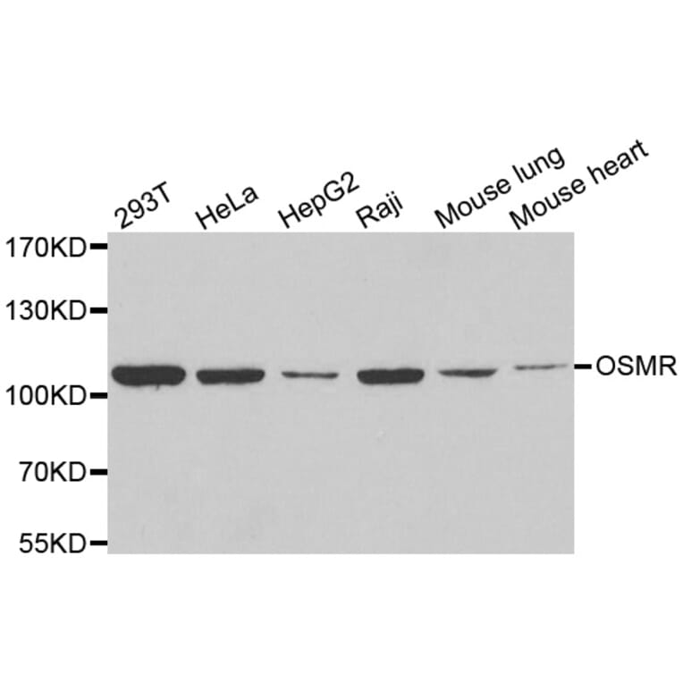 Western blot - OSMR antibody from Signalway Antibody (39095) - Antibodies.com