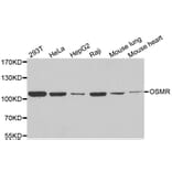 Western blot - OSMR antibody from Signalway Antibody (39095) - Antibodies.com