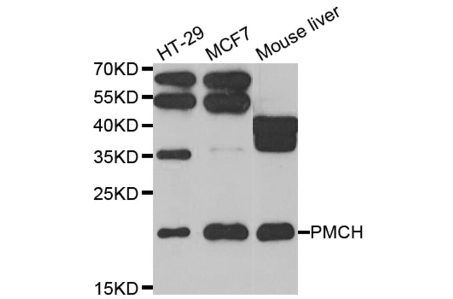 Western blot - PMCH antibody from Signalway Antibody (39106) - Antibodies.com