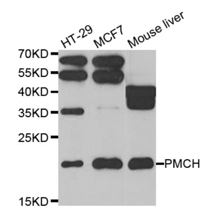 Western blot - PMCH antibody from Signalway Antibody (39106) - Antibodies.com