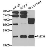 Western blot - PMCH antibody from Signalway Antibody (39106) - Antibodies.com