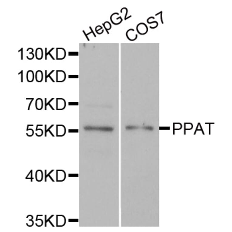 Western blot - PPAT antibody from Signalway Antibody (39111) - Antibodies.com