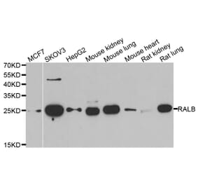 Western blot - RALB antibody from Signalway Antibody (39125) - Antibodies.com