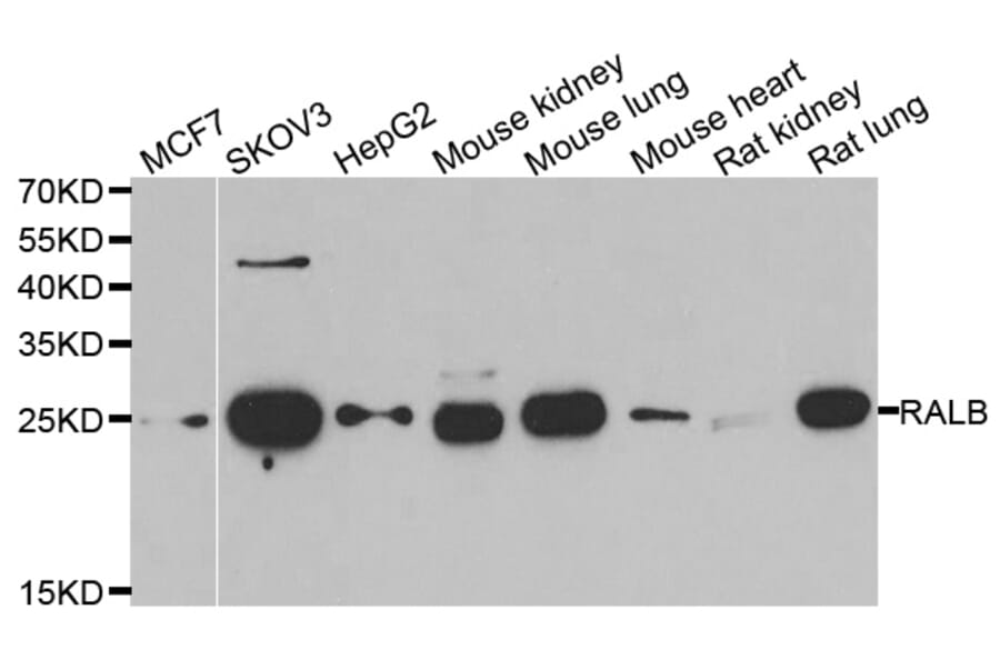 Western blot - RALB antibody from Signalway Antibody (39125) - Antibodies.com