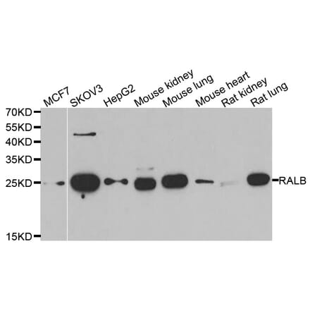 Western blot - RALB antibody from Signalway Antibody (39125) - Antibodies.com