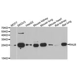 Western blot - RALB antibody from Signalway Antibody (39125) - Antibodies.com