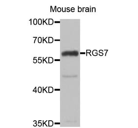 Western blot - RGS7 antibody from Signalway Antibody (39128) - Antibodies.com