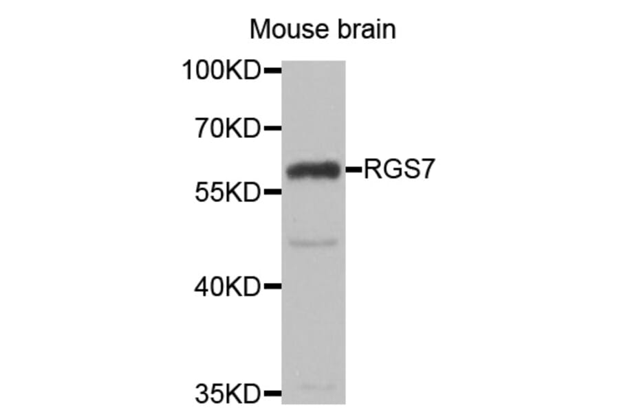 Western blot - RGS7 antibody from Signalway Antibody (39128) - Antibodies.com