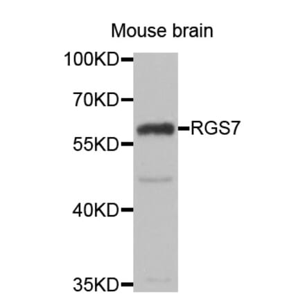 Western blot - RGS7 antibody from Signalway Antibody (39128) - Antibodies.com