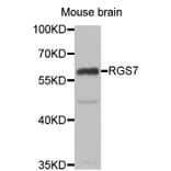 Western blot - RGS7 antibody from Signalway Antibody (39128) - Antibodies.com